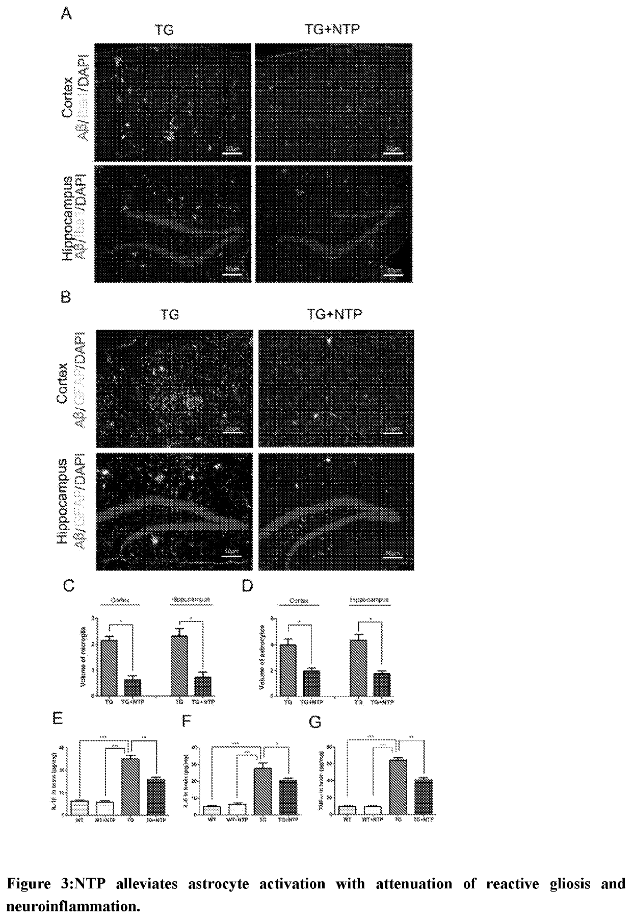 Inhibiting or alleviating agent for inflammation in the brain