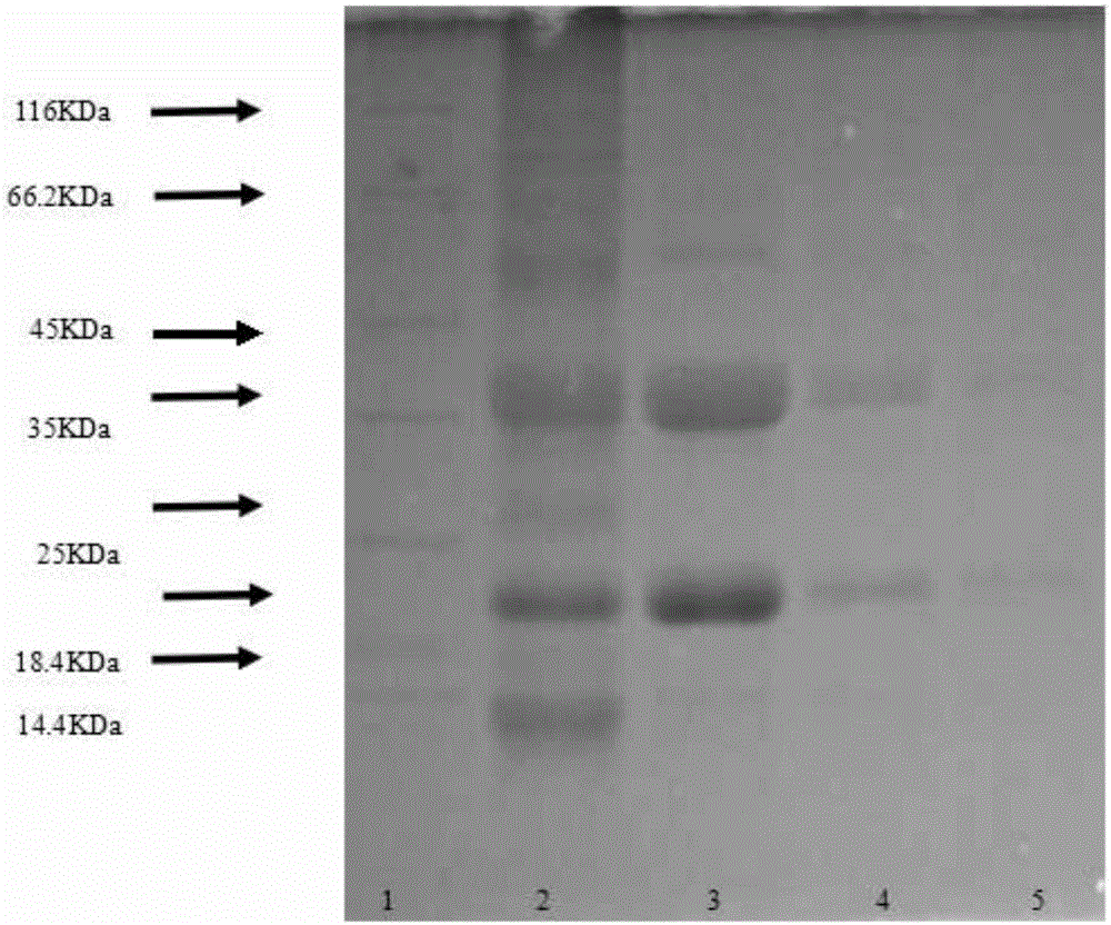Method for extracting high-purity rice glutelin