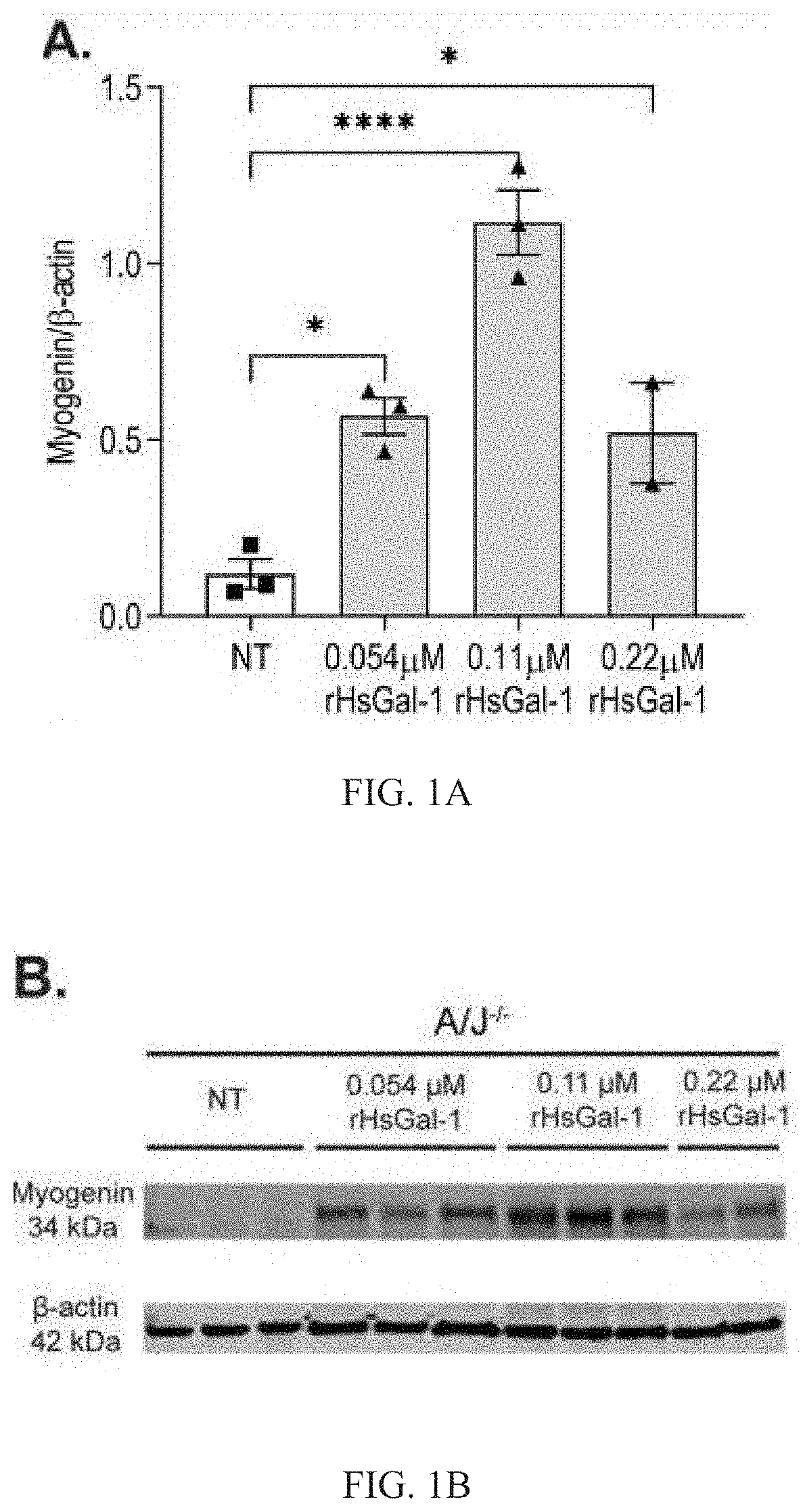 Galectin-1 immunomodulation and myogenic improvements in muscle diseases and autoimmune disorders