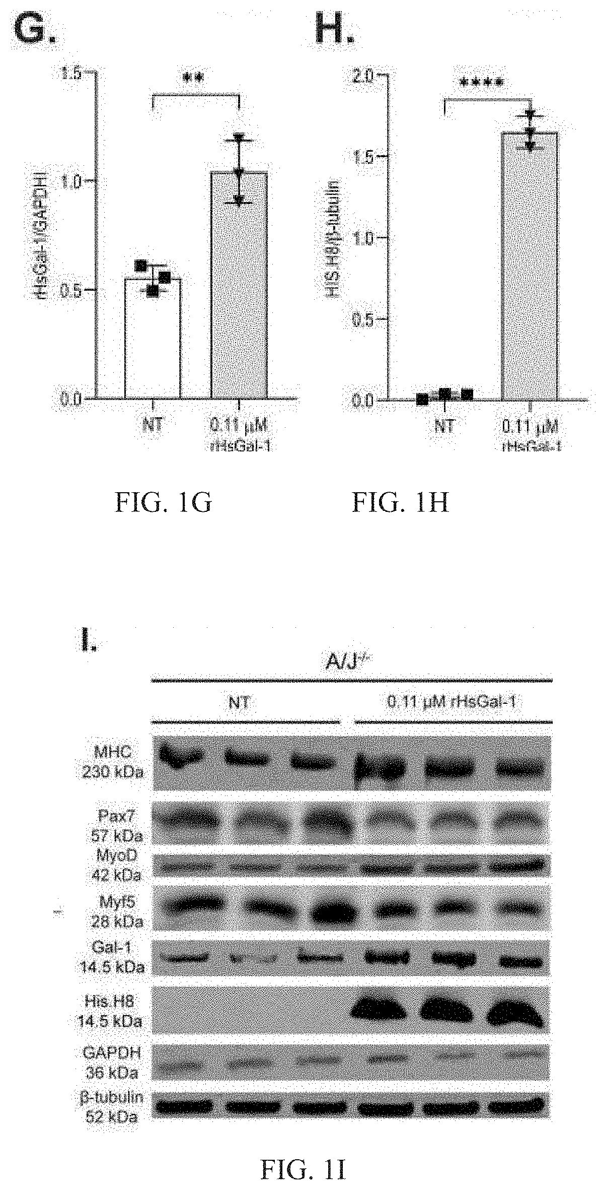 Galectin-1 immunomodulation and myogenic improvements in muscle diseases and autoimmune disorders