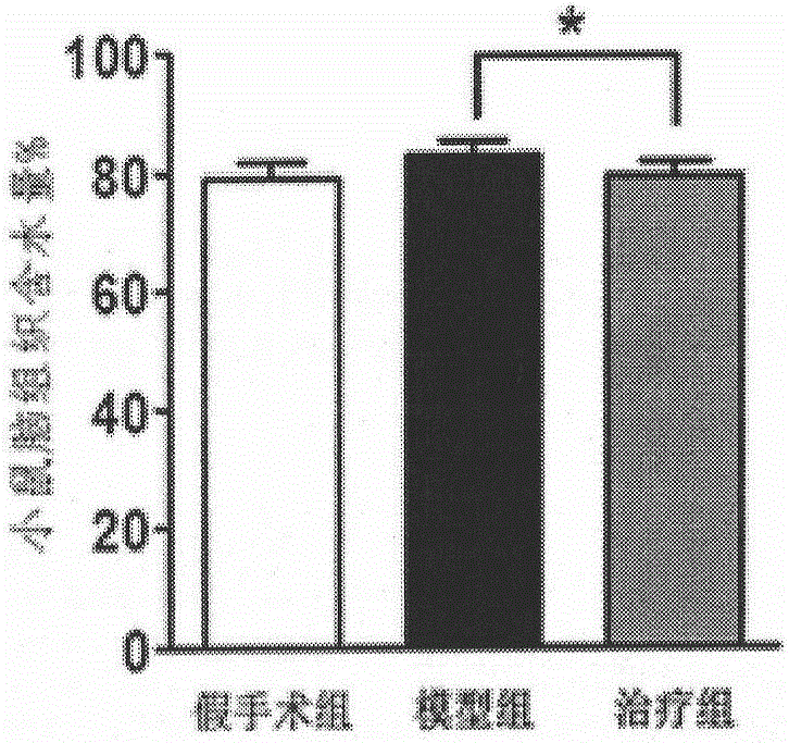 Application of domperidone in preparation of therapeutics for cerebral ischemia-reperfusion injury