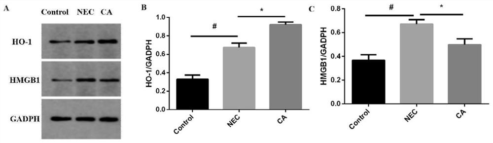 Application of coniferyl aldehyde in preparation of medicine for treating neonatal necrotizing enterocolitis