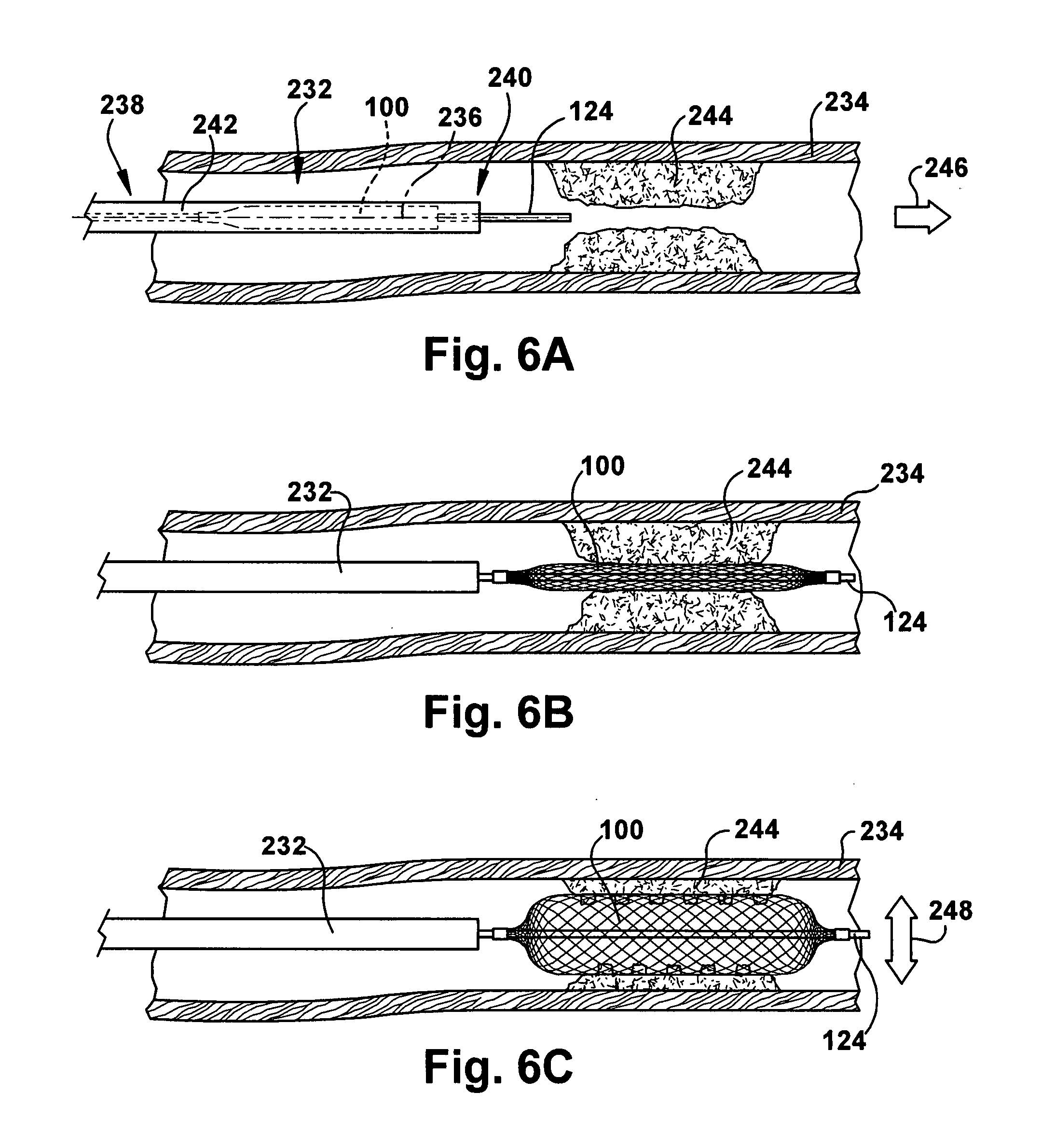 Method and apparatus for increasing blood flow through an obstructed blood vessel