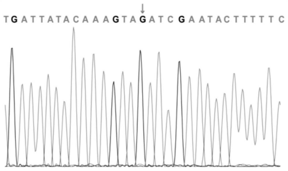 Mutation site of intellectual disability disease-related ATRX gene and detection kit