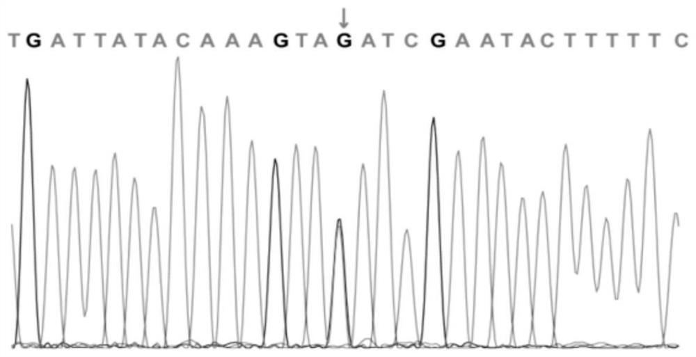 Mutation site of intellectual disability disease-related ATRX gene and detection kit