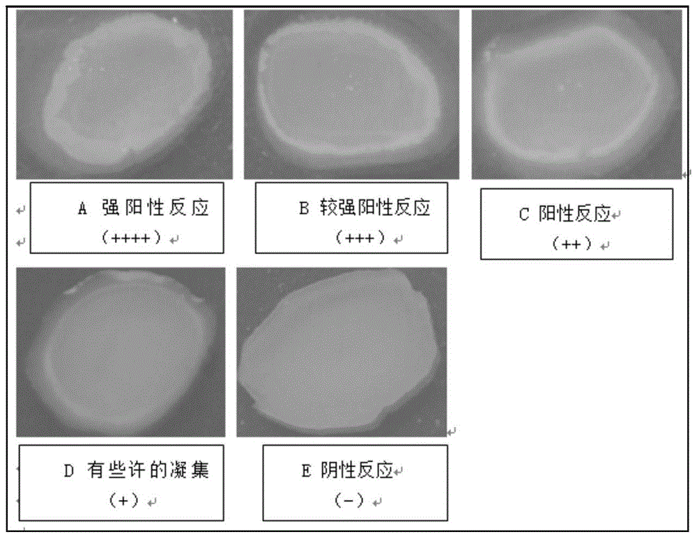 A kind of enterohaemorrhagic Escherichia coli o157:h7 latex agglutination detection kit and its application