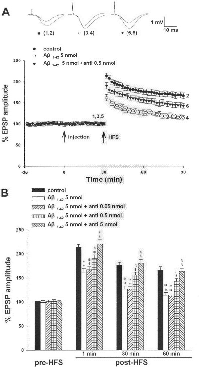 Anti-aβ31-35 antibody for treating and preventing Alzheimer's disease and preparation method thereof