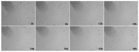 Method for efficiently inducing human cells to be reprogrammed into neuronal cells