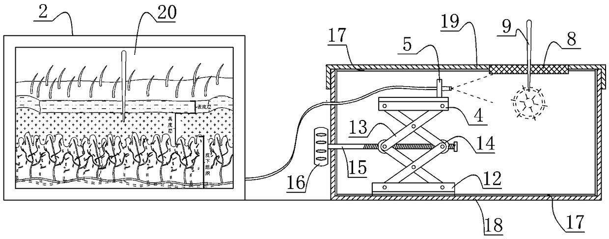 Intelligent device and method for simulating acupuncture therapy