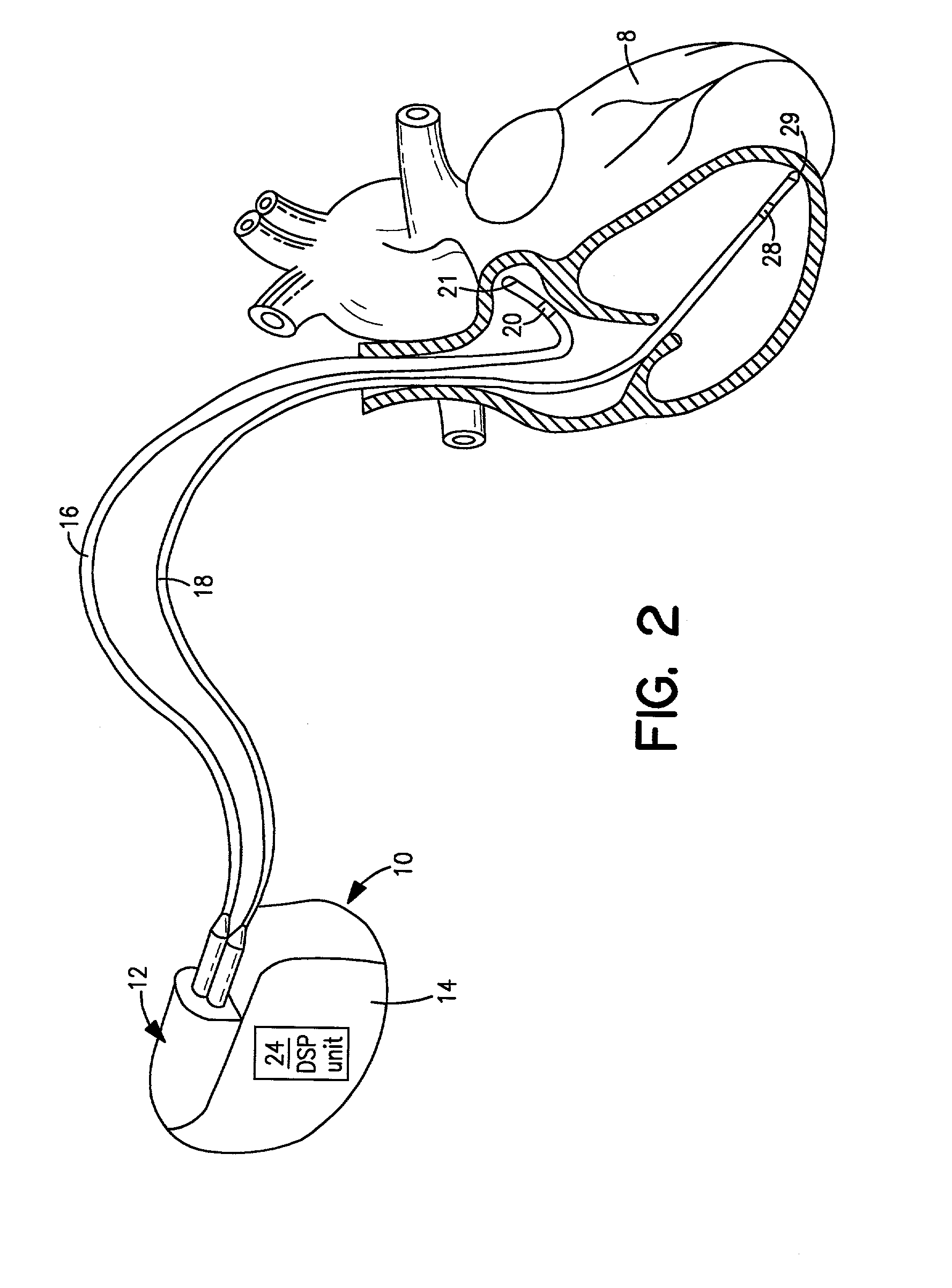 Method and system for transferring and storing data in a medical device with limited storage and memory