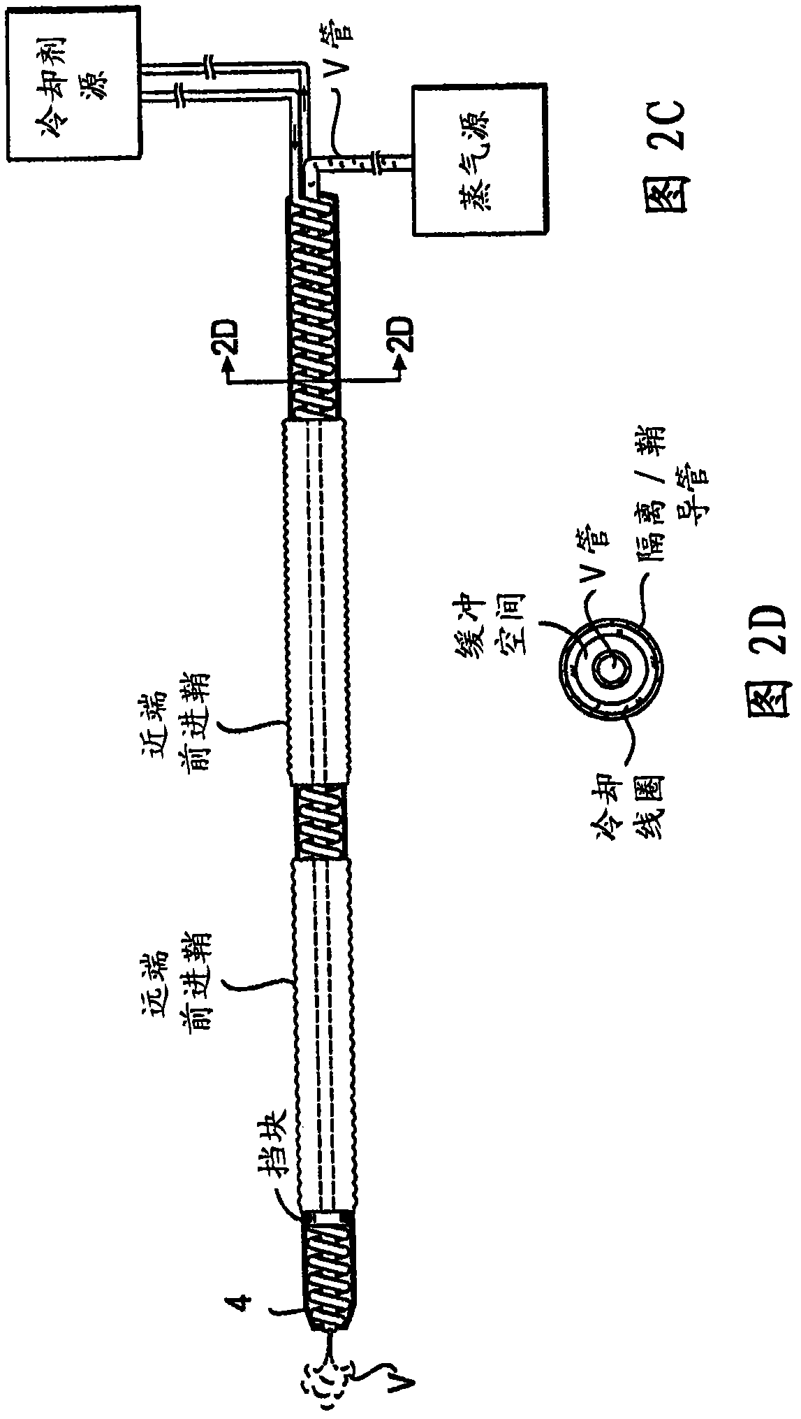 Vein therapy device and method
