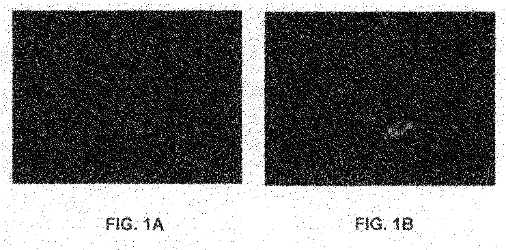 Methods of inhibiting smooth muscle cell migration and proliferation