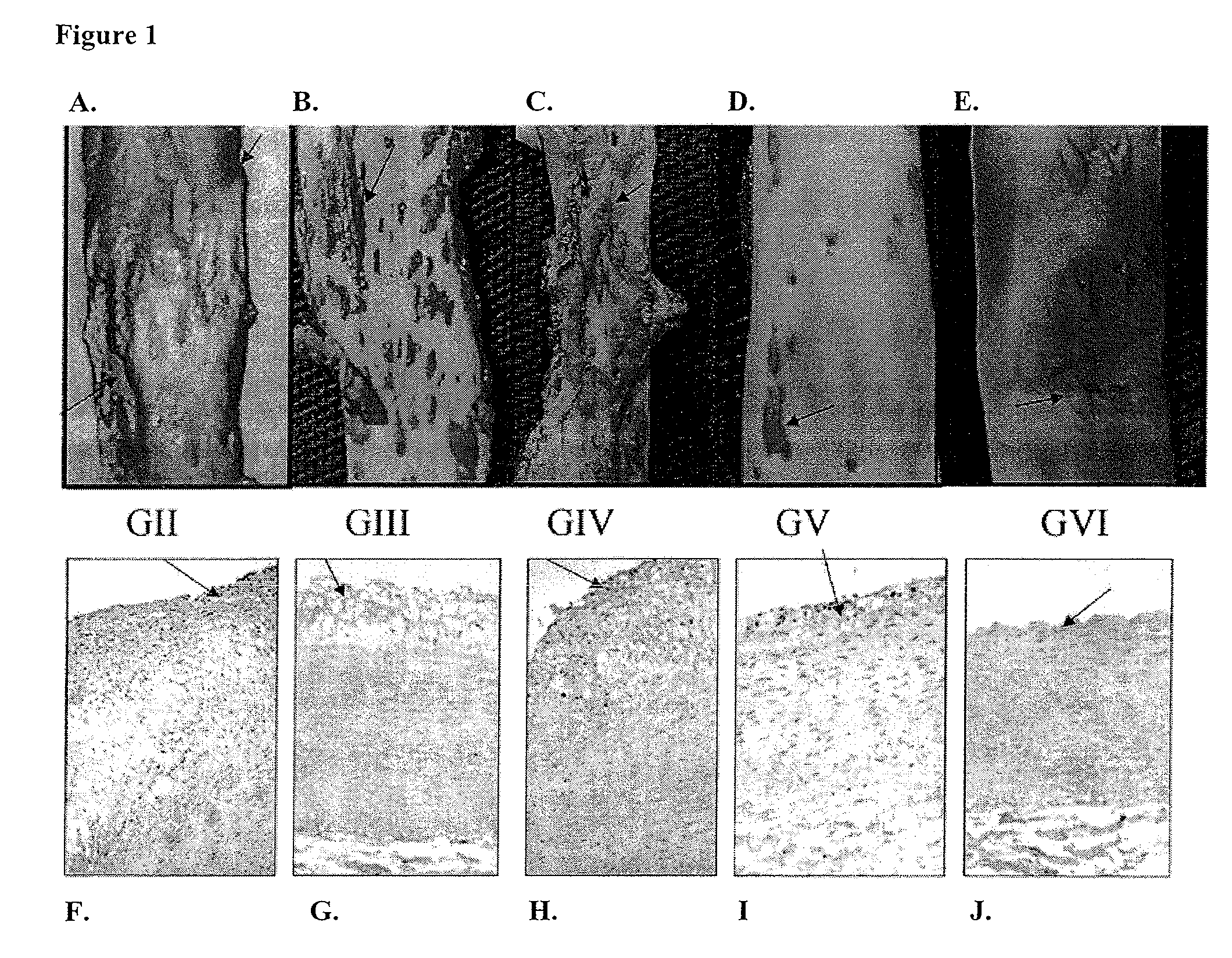 Compositions for inhibiting atherosclerosis