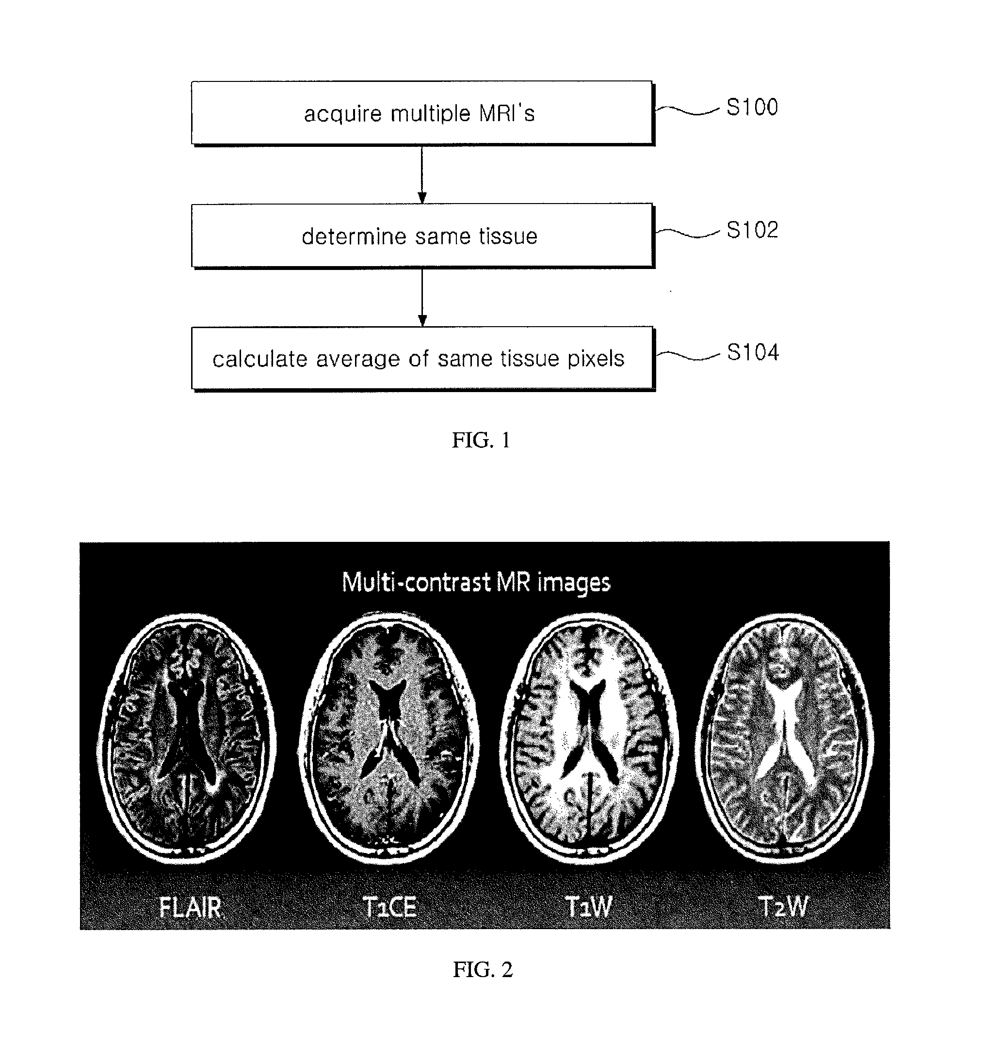 Denoising method and apparatus for multi-contrast MRI