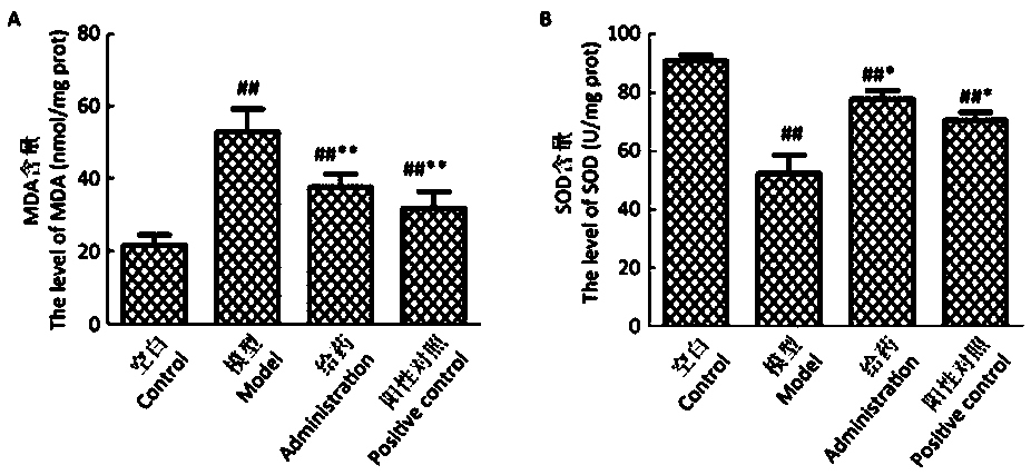 Application of aqueous extract of cordyceps militaris sporophore in liver protection product