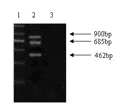 Method for quickly detecting pathogenic aeromonas hydrophila by multiple polymerase chain reactions (PCRs)