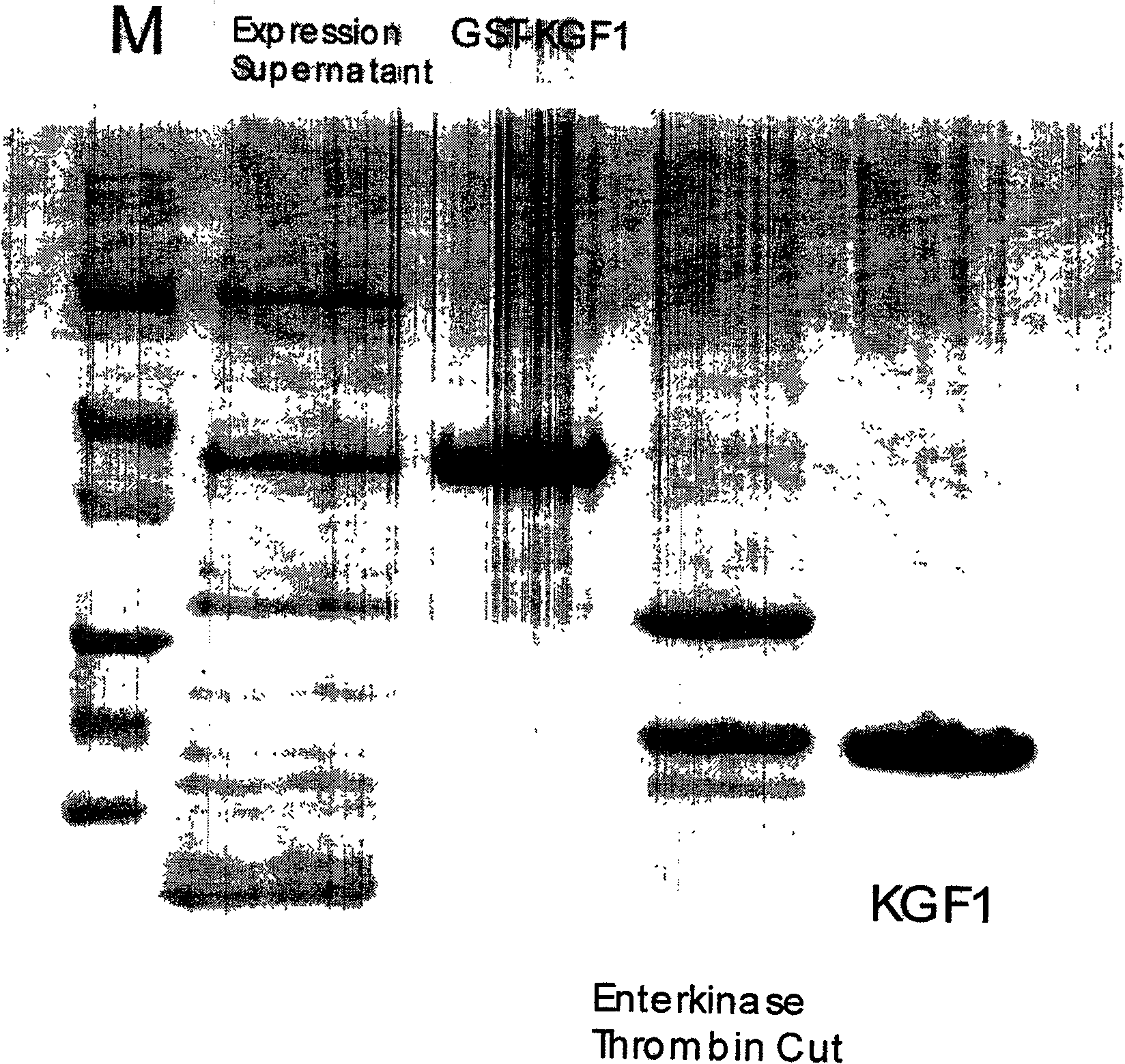 Recombinant human keratinized cell growth factor production method