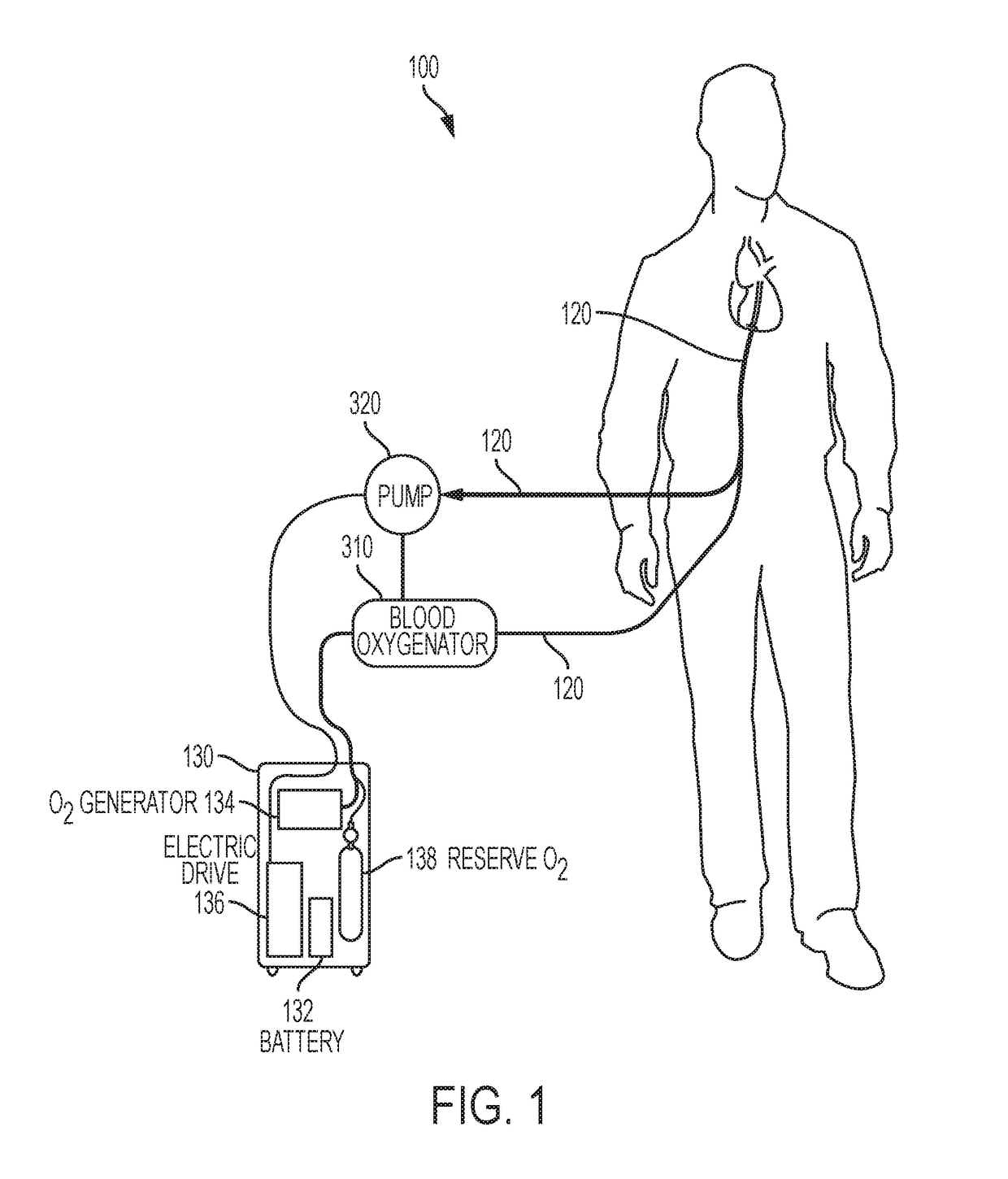 Artificial lung system and its methods of use