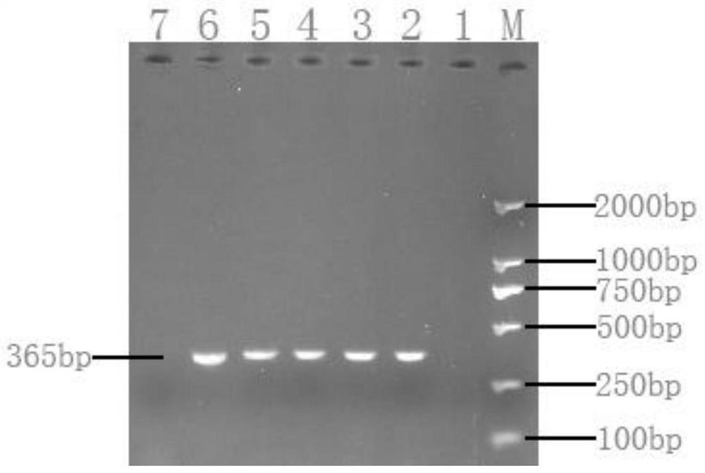 A specific primer for detecting Acinetobacter johnsonii and its method and application