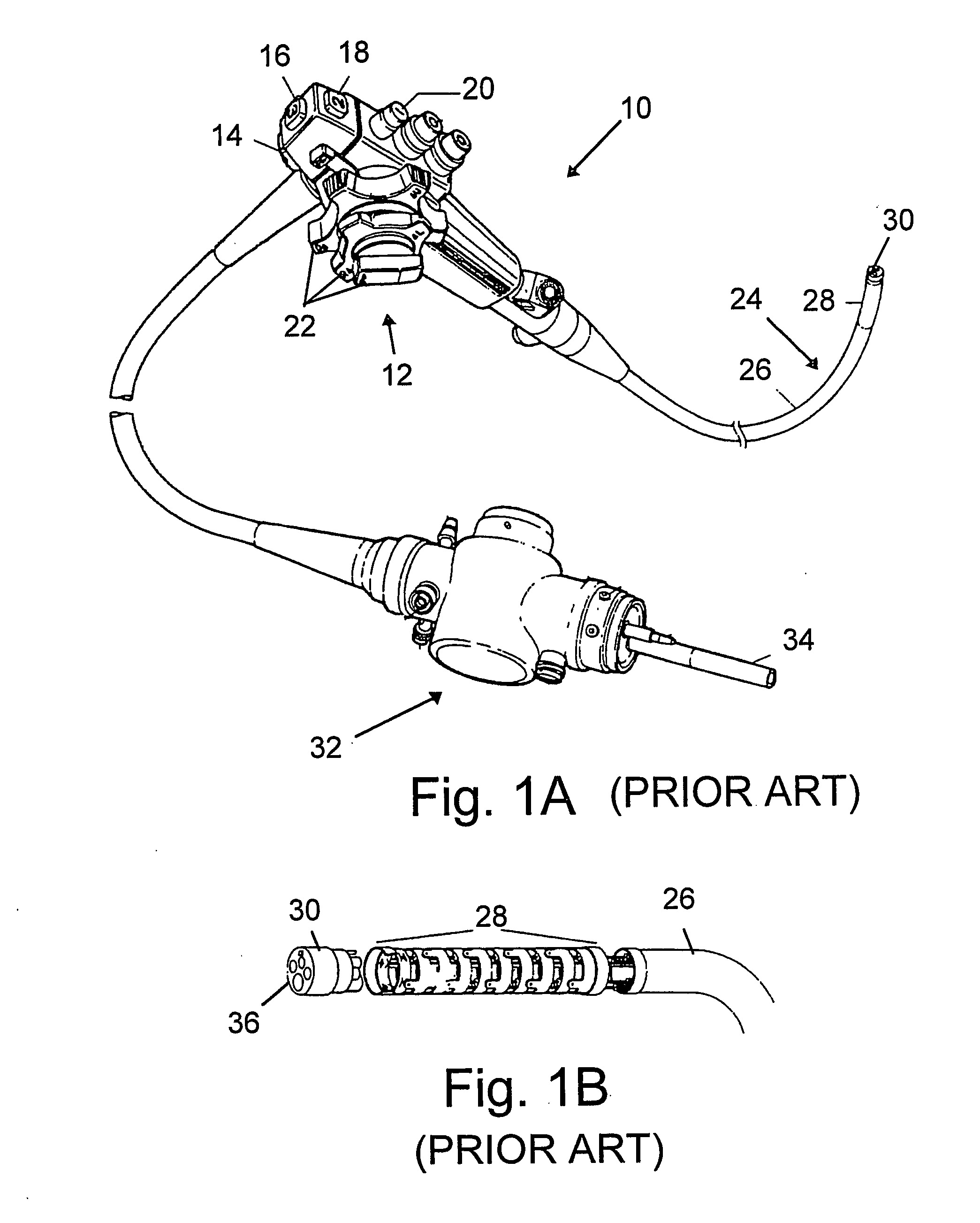 Devices and methods for treating morbid obesity