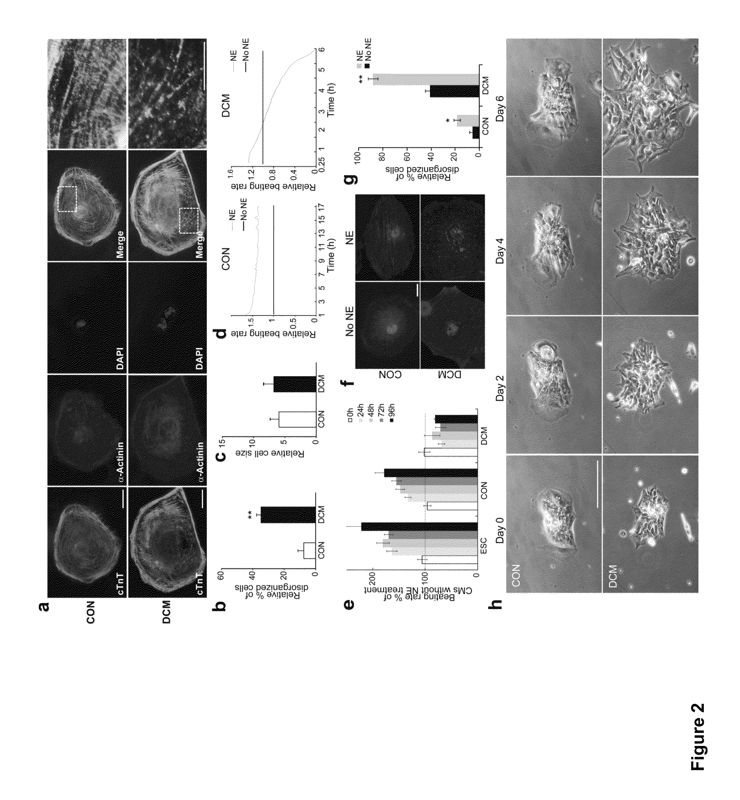 Cardiomyocytes from induced pluripotent stem cells from patients and methods of use thereof