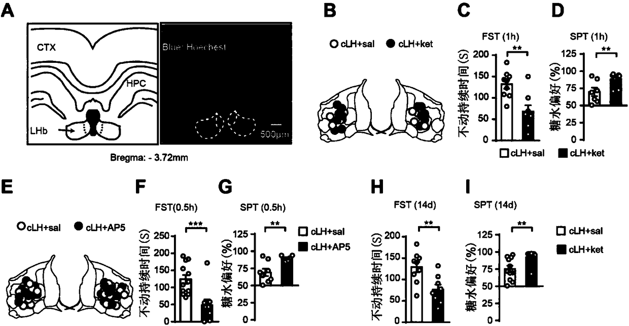 Therapy of depression by combination of NMDAR inhibitor and T-type calcium channel inhibitor and drug