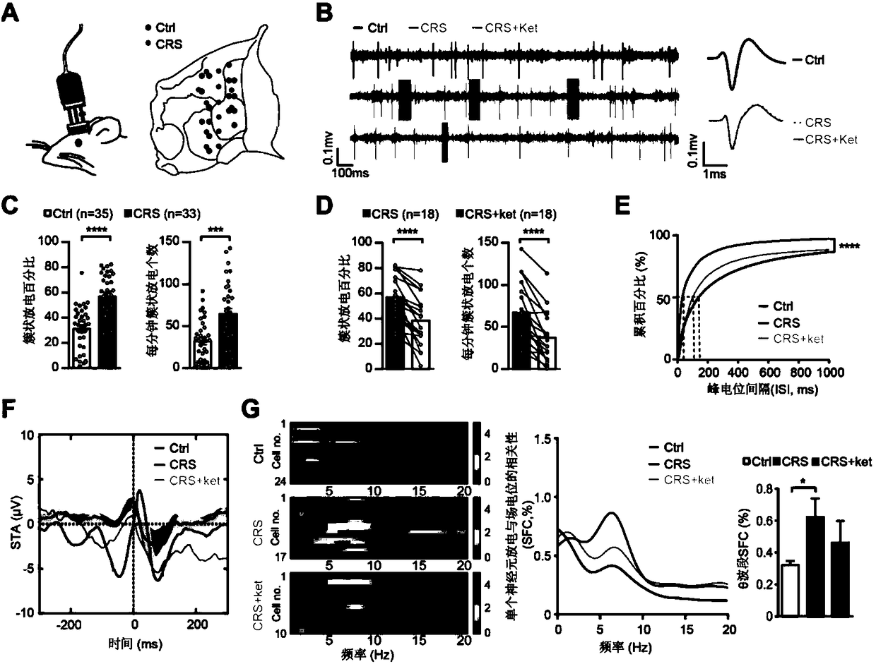 Therapy of depression by combination of NMDAR inhibitor and T-type calcium channel inhibitor and drug