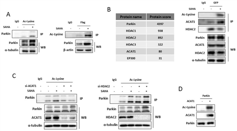 Acetylation of human parkin protein and application of parkin protein in medicine preparation