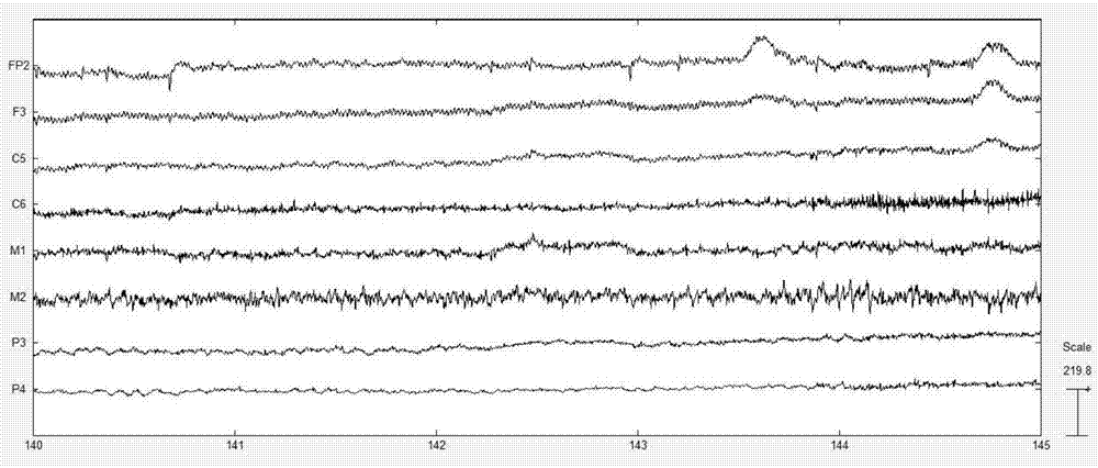 Emotional recognition feature extracting method based on electroencephalogram signal of dual-tree complex wavelet