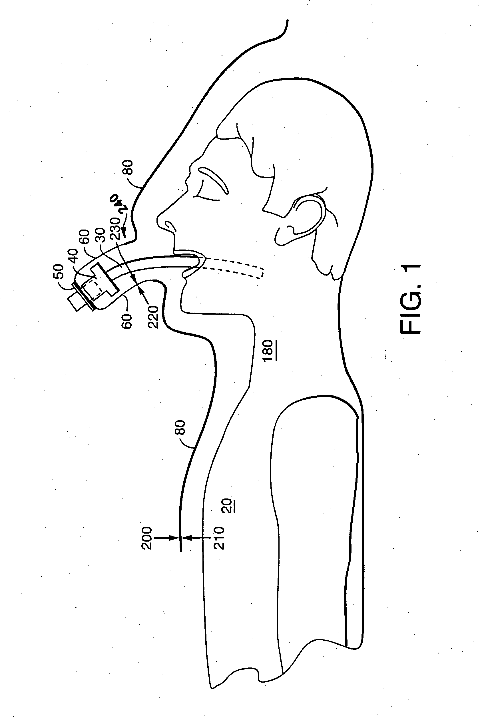 Drape for open tracheal suctioning