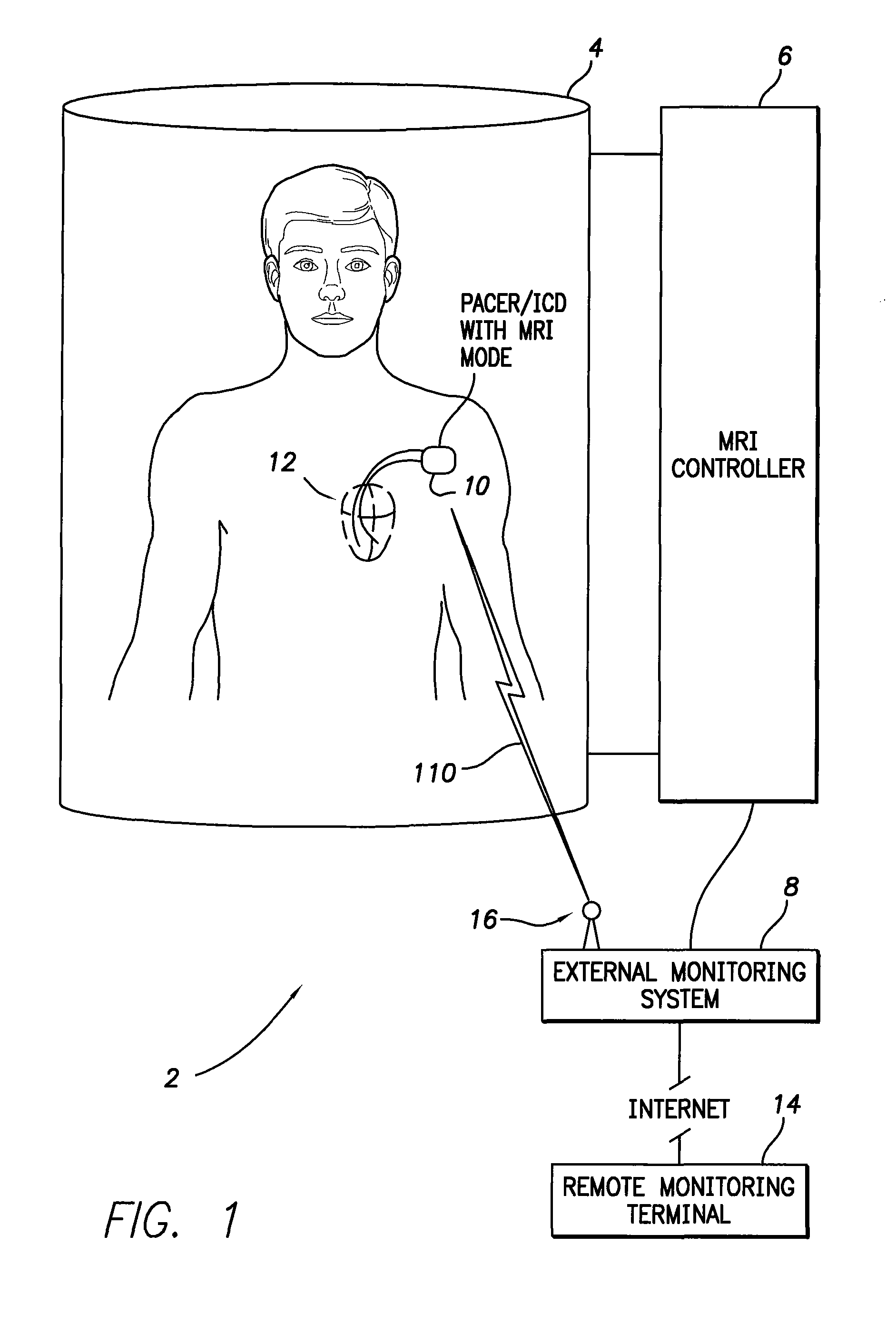 Systems and methods for remote monitoring of signals sensed by an implantable medical device during an MRI
