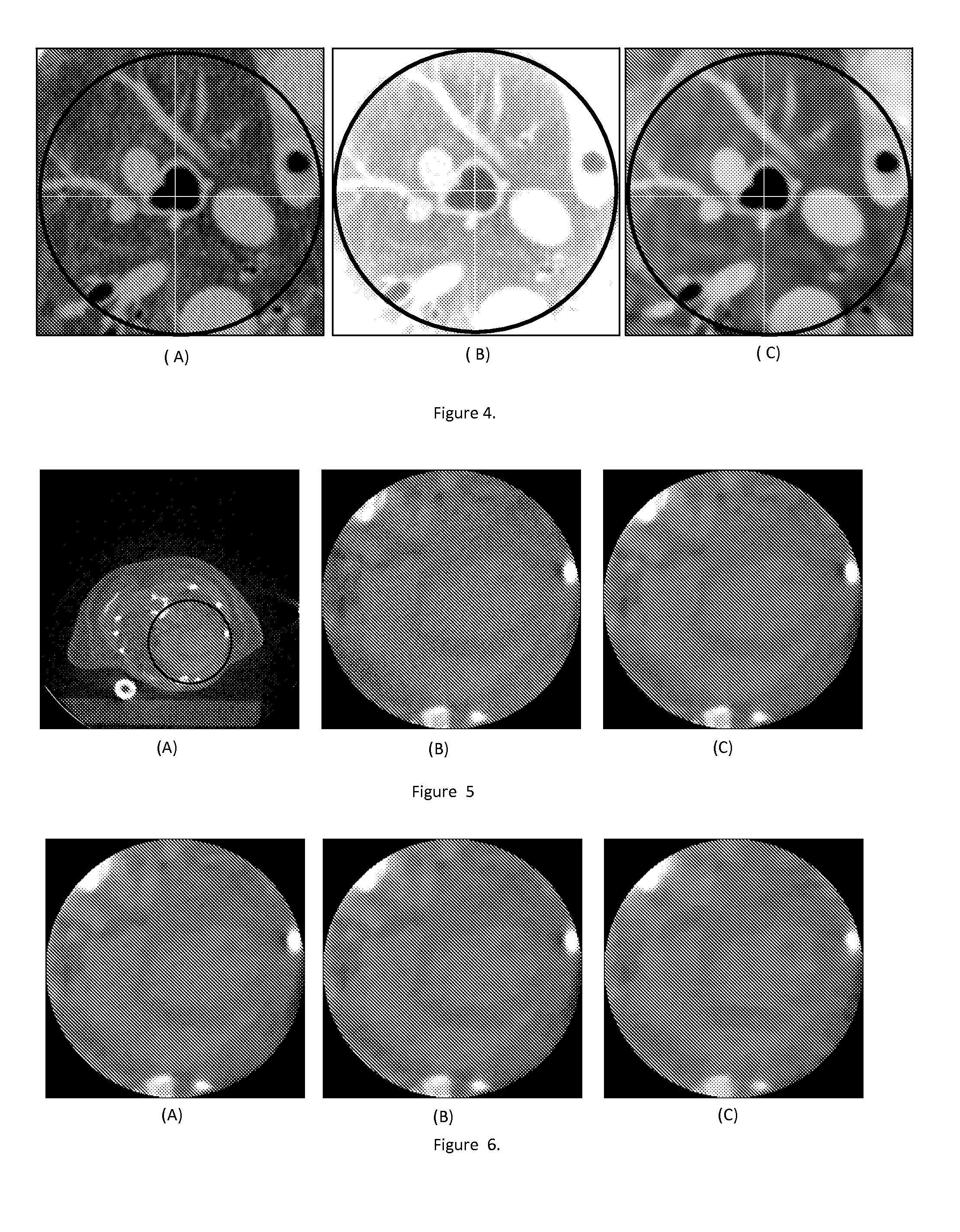 Exact local computed tomography based on compressive sampling