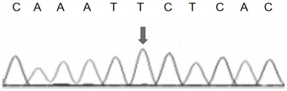 Dilated cardiomyopathy gene detection marker and application thereof