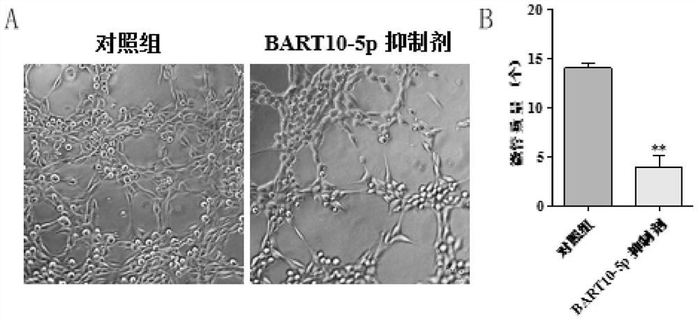 Application of Epstein-Barr virus mir-bart10-5p inhibitor