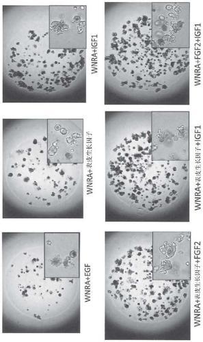 Cell culture medium for culturing organoid, culture method, and organoid