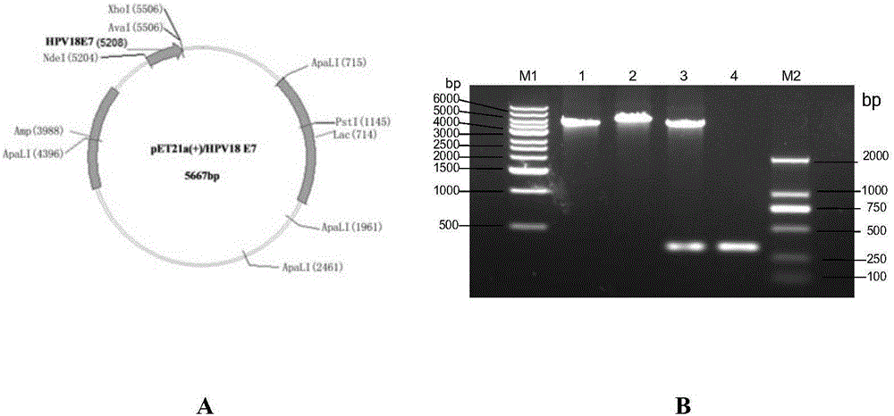 Polypeptide with binding affinity for HPV18 E7 protein and application thereof