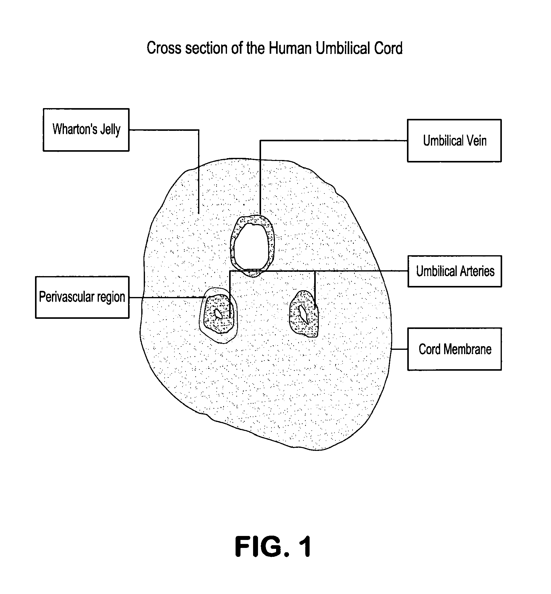 Methods for isolating mononuclear cells that include a subpopulation of mesenchymal progenitor cells and vascular cells that include a subpopulation of endothelial progenitor cells from umbilical cord tissue