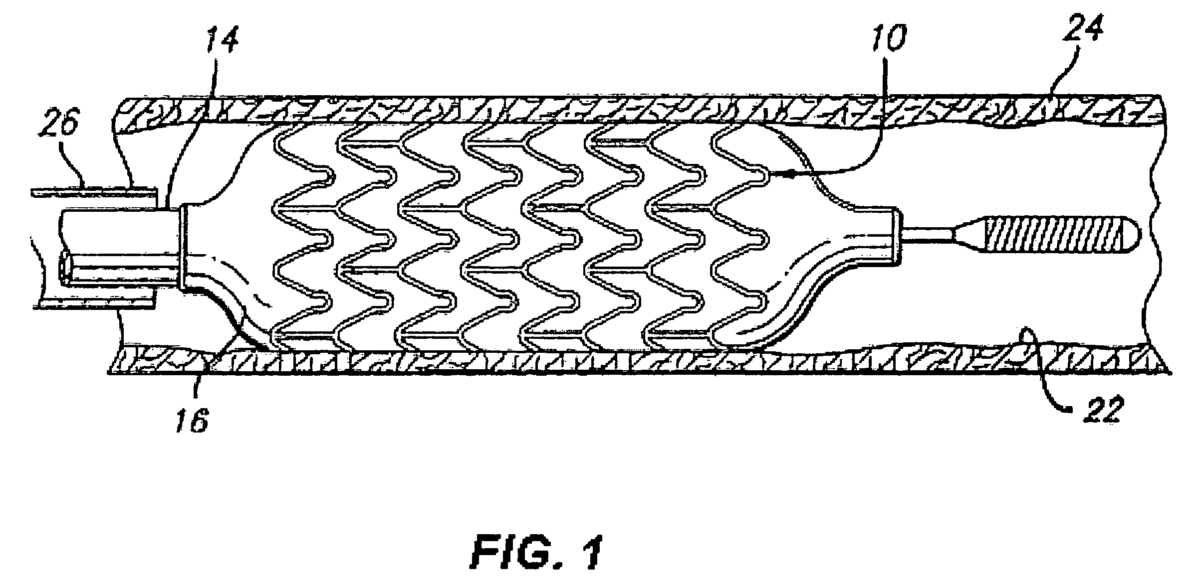 Radiopaque markers and medical devices comprising binary alloys of titanium