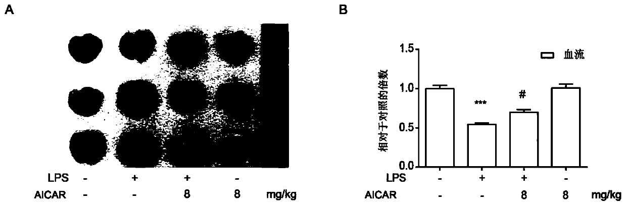 Application of ozone in treatment of sepsis complications caused by noval coronavirus 2019 infection