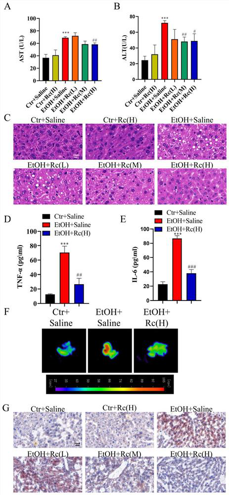 Application of ginsenoside Rc in preparation of medicine for treating alcoholic fatty liver