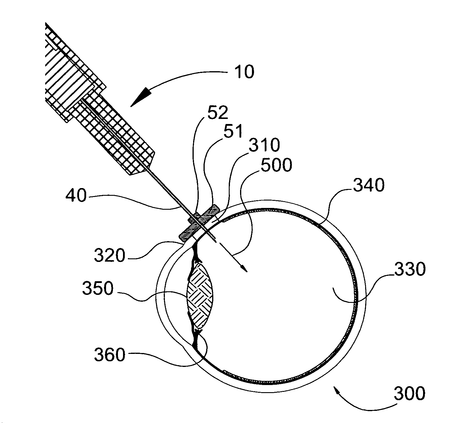 Intravitreal injection device and system