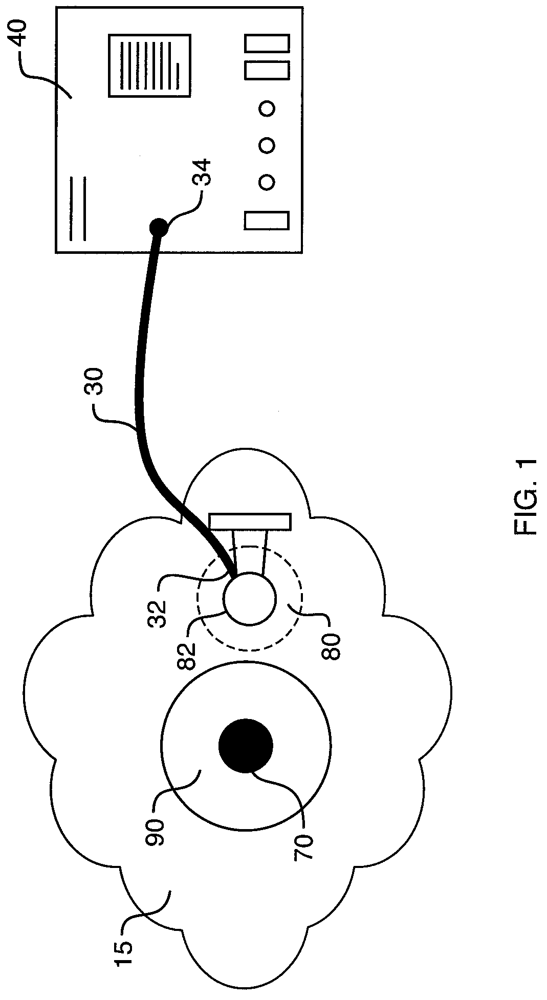 Electrode connection system