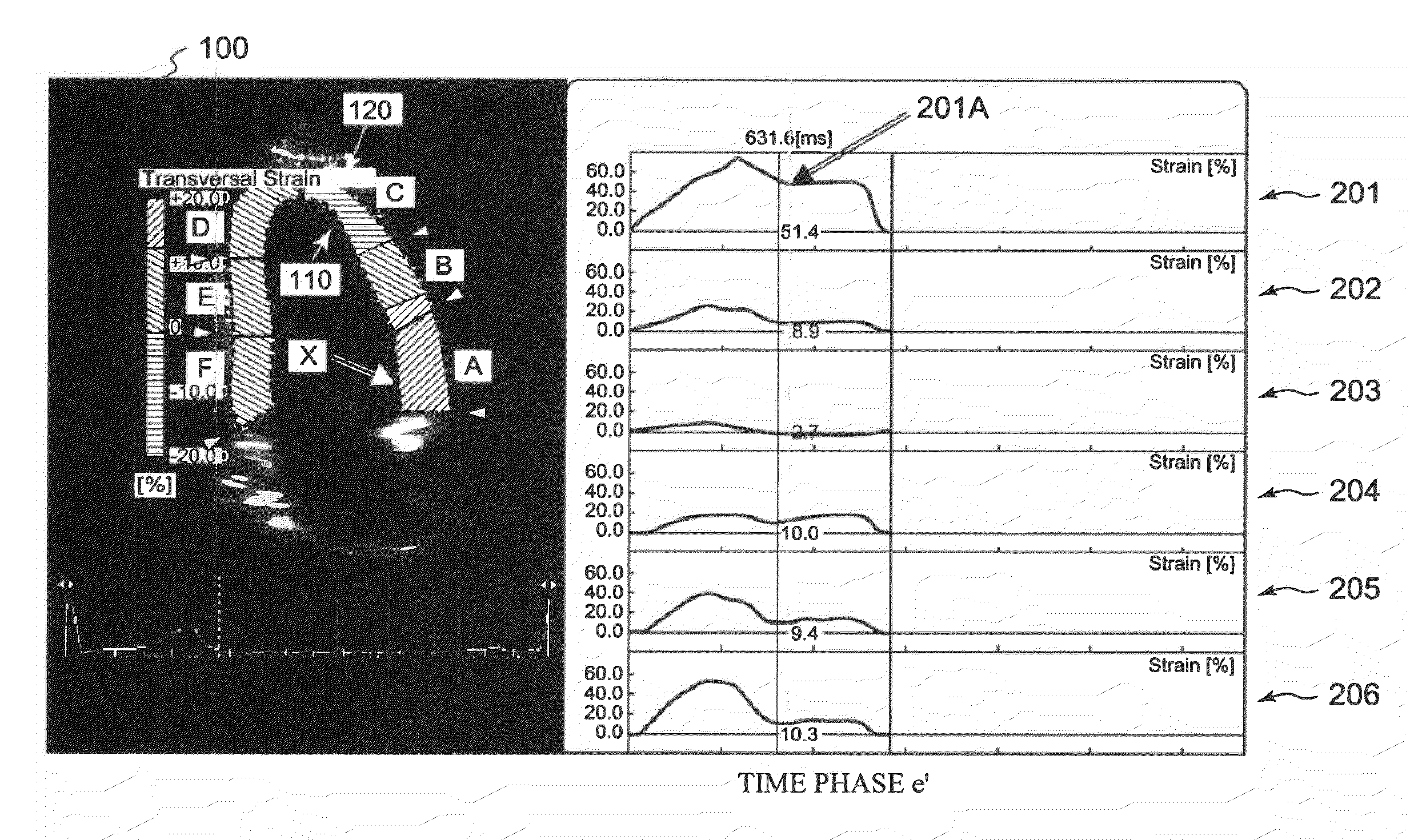 Ultrasound imaging apparatus and method for processing ultrasound image
