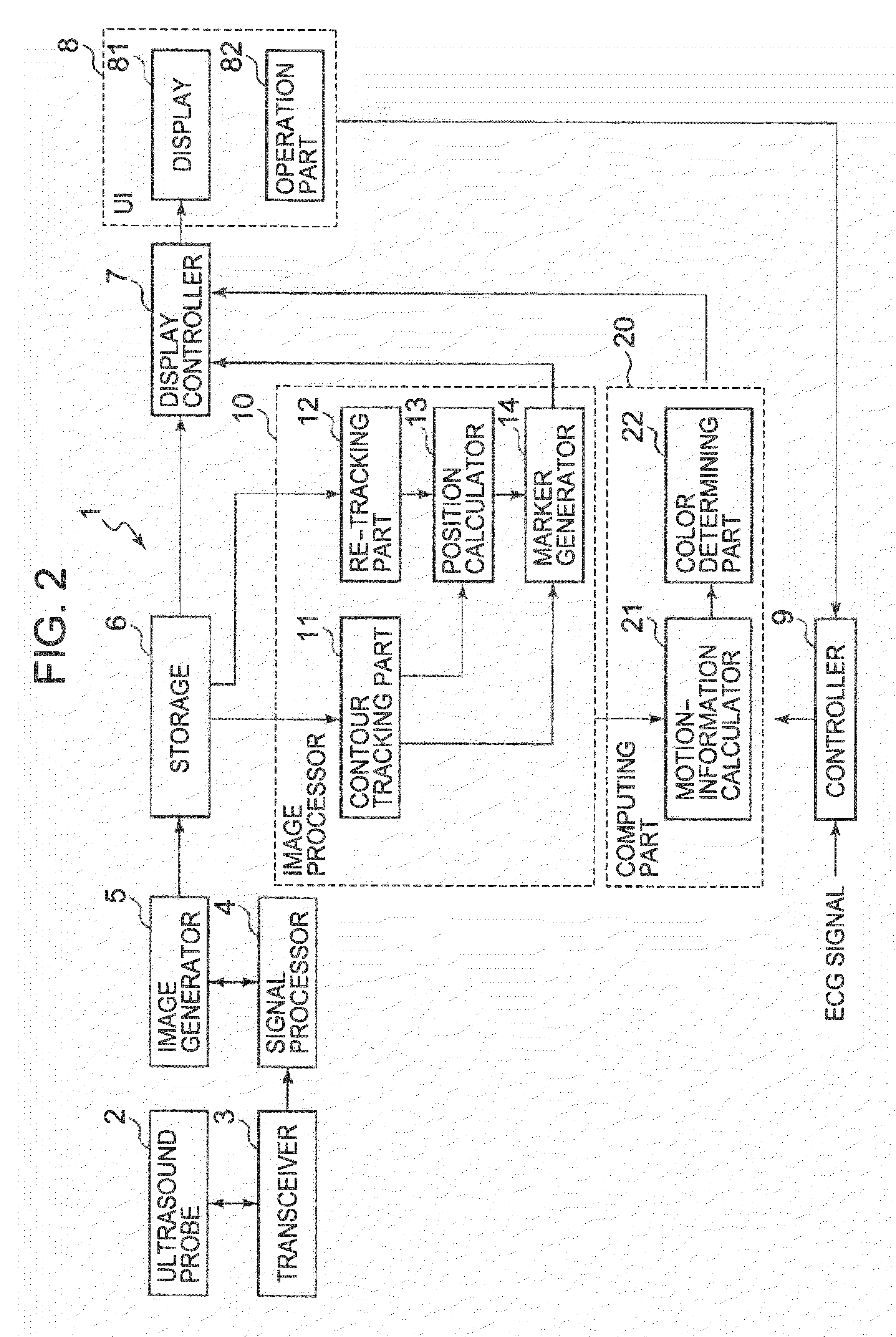 Ultrasound imaging apparatus and method for processing ultrasound image