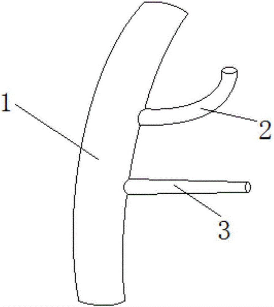 Digestive tract connector for reconstructing digestive tract in duodenectomy