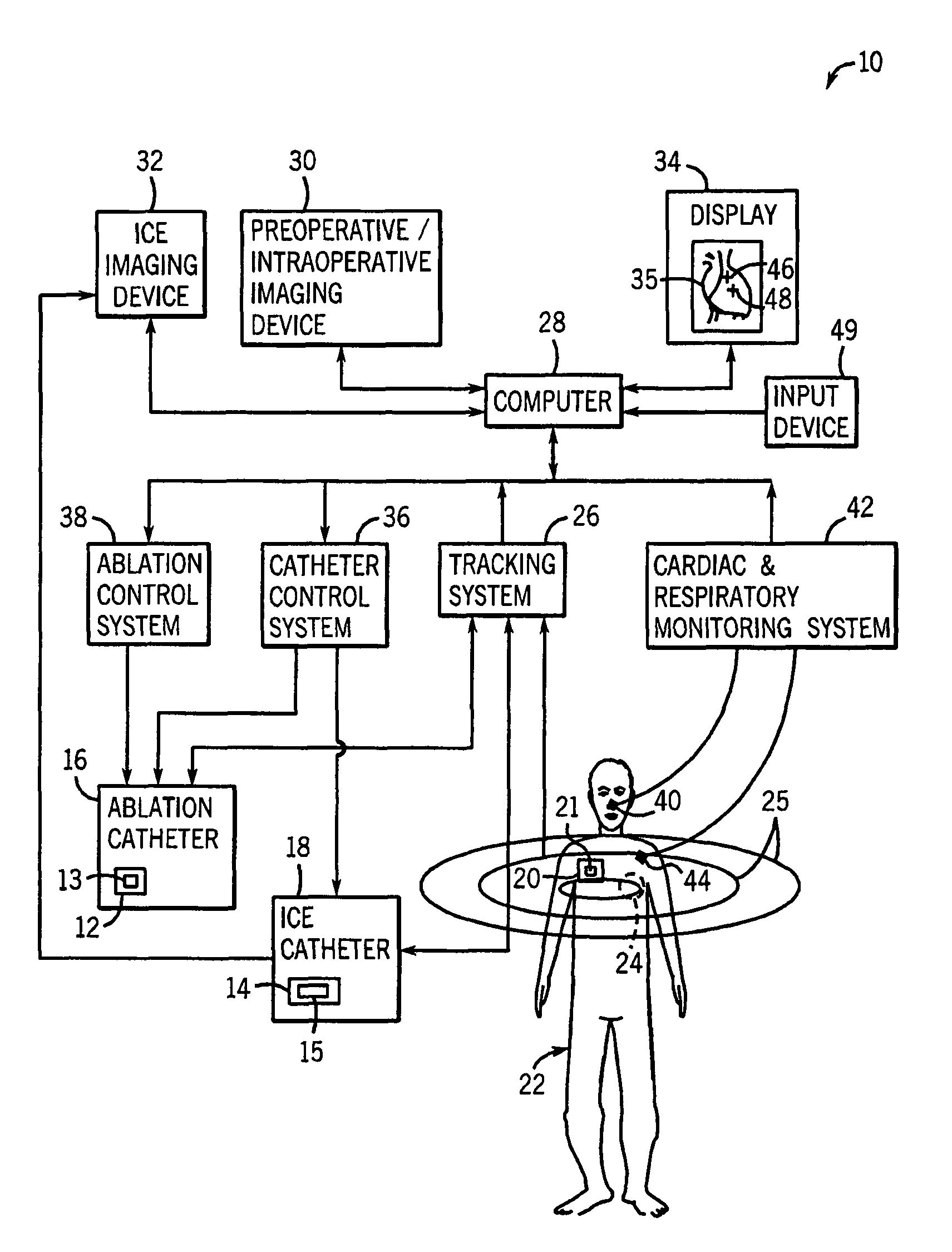 Navigation and imaging system sychronized with respiratory and/or cardiac activity
