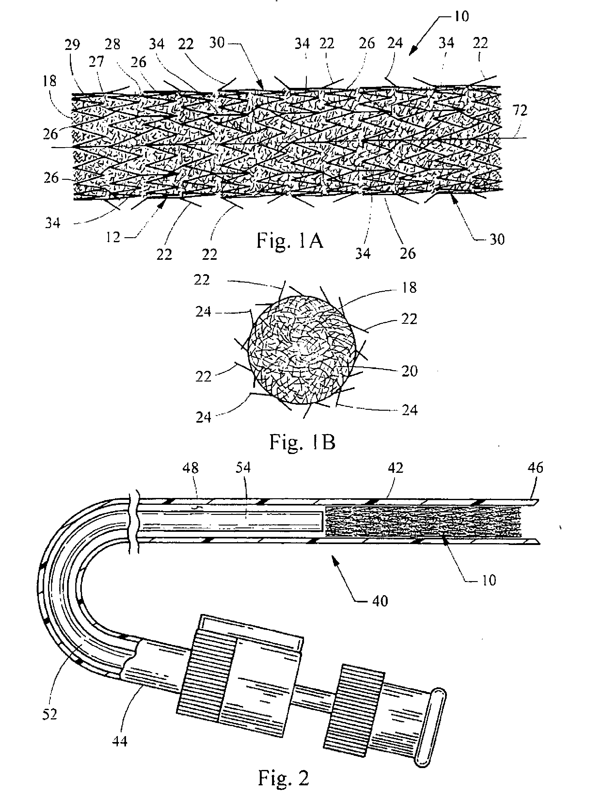 Barbed stent vascular occlusion device