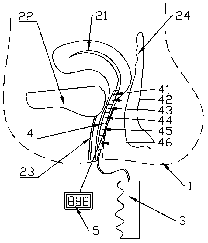 Device for detecting pelvic floor organ displacement and clinical characteristics