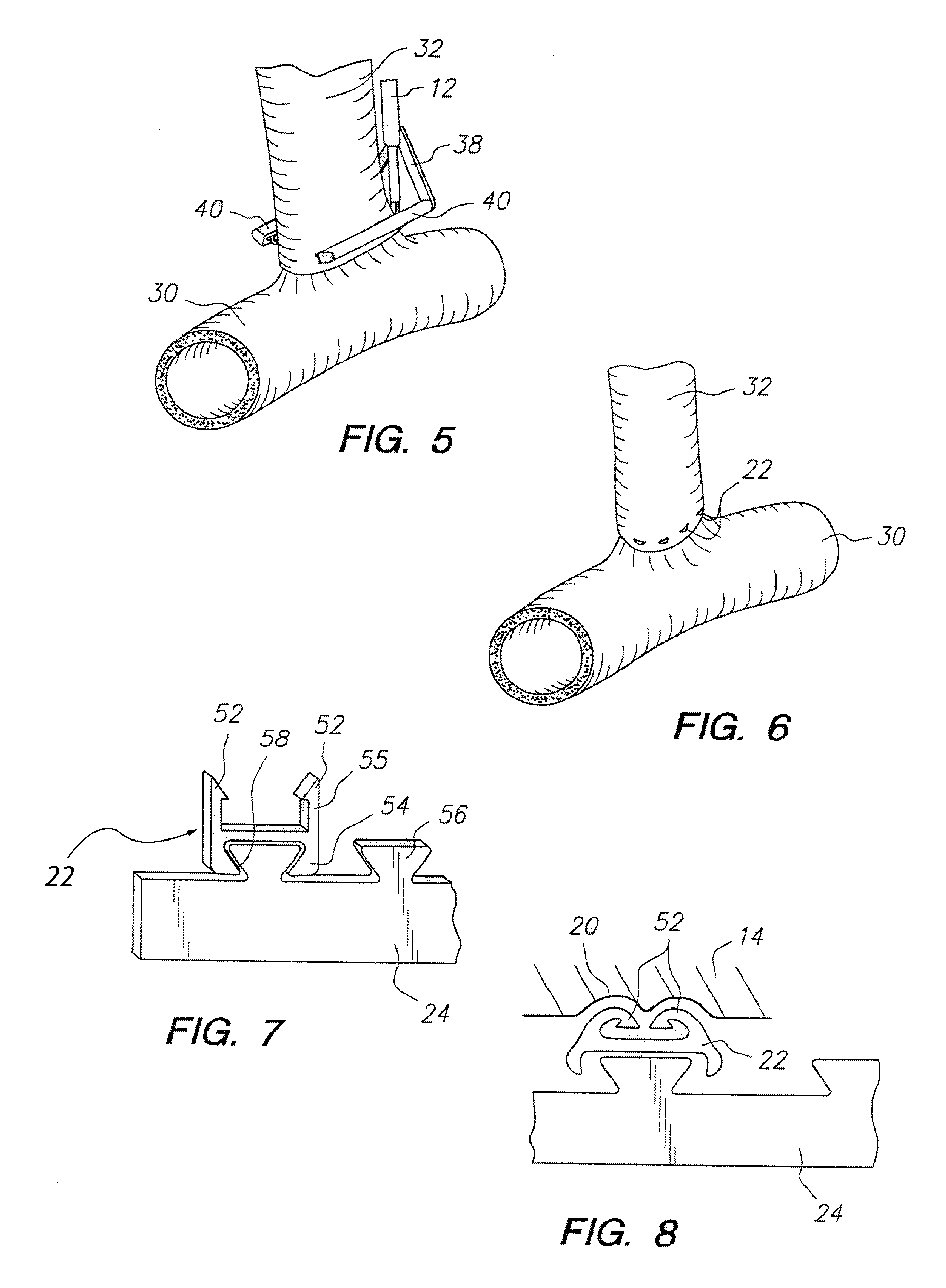 System for performing anastomosis