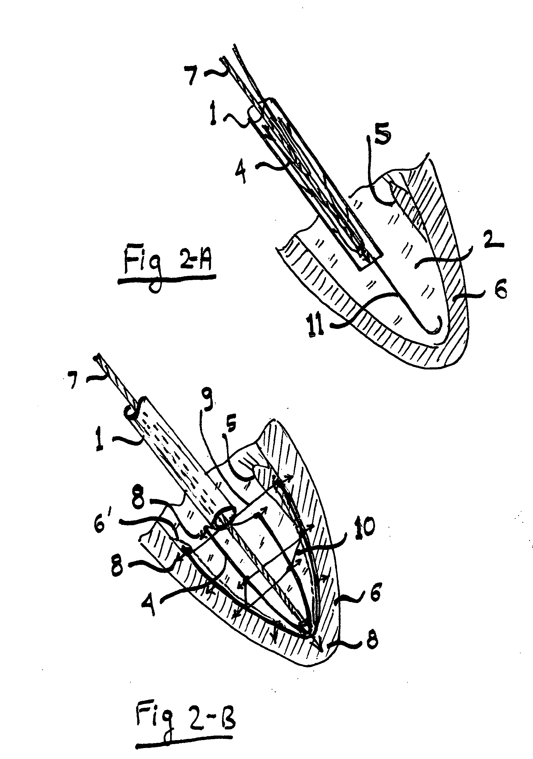 System for improving diastolic dysfunction